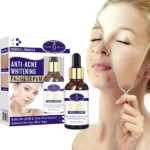 Aichun Beauty Anti-Acne Whitening Serum with Aloe Vera 30ml - Image 2