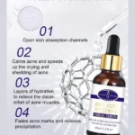 Aichun Beauty Anti-Acne Whitening Serum with Aloe Vera 30ml - Image 3