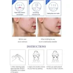 Aichun Beauty Anti-Acne Whitening Serum with Aloe Vera 30ml - Image 5