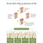 Buy now Aichun Beauty Anti – Acne Whitening Facial Serum Aloe Vera Extract Salicylic Acid Repairs Damaged Skin 30ml