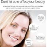 Shop now Aichun Beauty Anti – Acne Whitening Facial Serum Aloe Vera Extract Salicylic Acid Repairs Damaged Skin 30ml