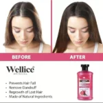 Wellice Onion Hair Oil – Anti Hair Loss & Hair Growth Formula (150ml) - Image 3