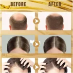 Wellice Onion Hair Oil – Anti Hair Loss & Hair Growth Formula (150ml) - Image 4