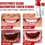 Yayashi SP-4 ultra whitening toothpaste probiotic stain remover 120g