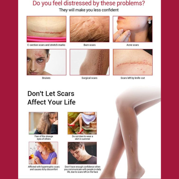 Shop now Aichun Beauty Scar Removal Serum