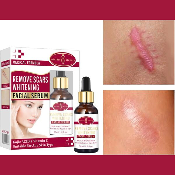 Aichun Beauty Scar Removal Serum | Fades Scars, Pimples & Stretch Marks | Kojic Acid & Vitamin E | 30ml - Image 5