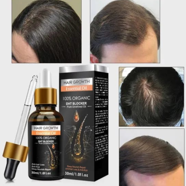 Hair Growth Essential Oil–Anti-Hair Loss & Nourishing (30ml) - Image 3